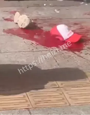 精神病患者管理